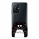 Funda Xiaomi 11T Watch Cats