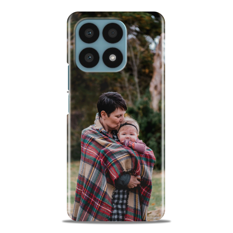 Funda
 personalizada del Honor X8a