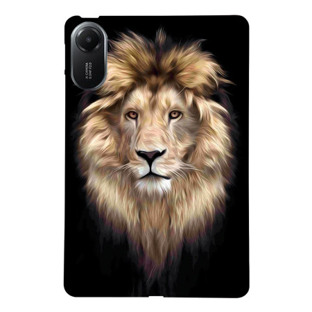 Xiaomi Redmi Pad 2 Caso...